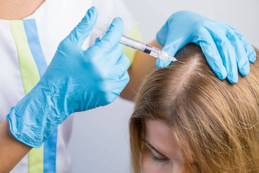 حقن بلازما PRP لعلاج تساقط الشعر