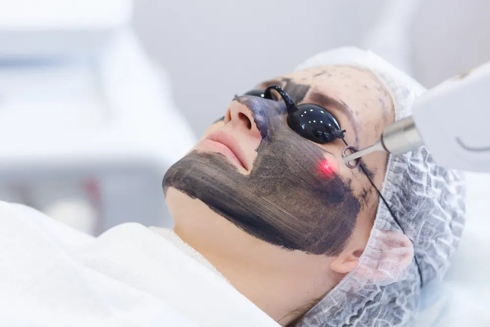 إزالة التصبغات