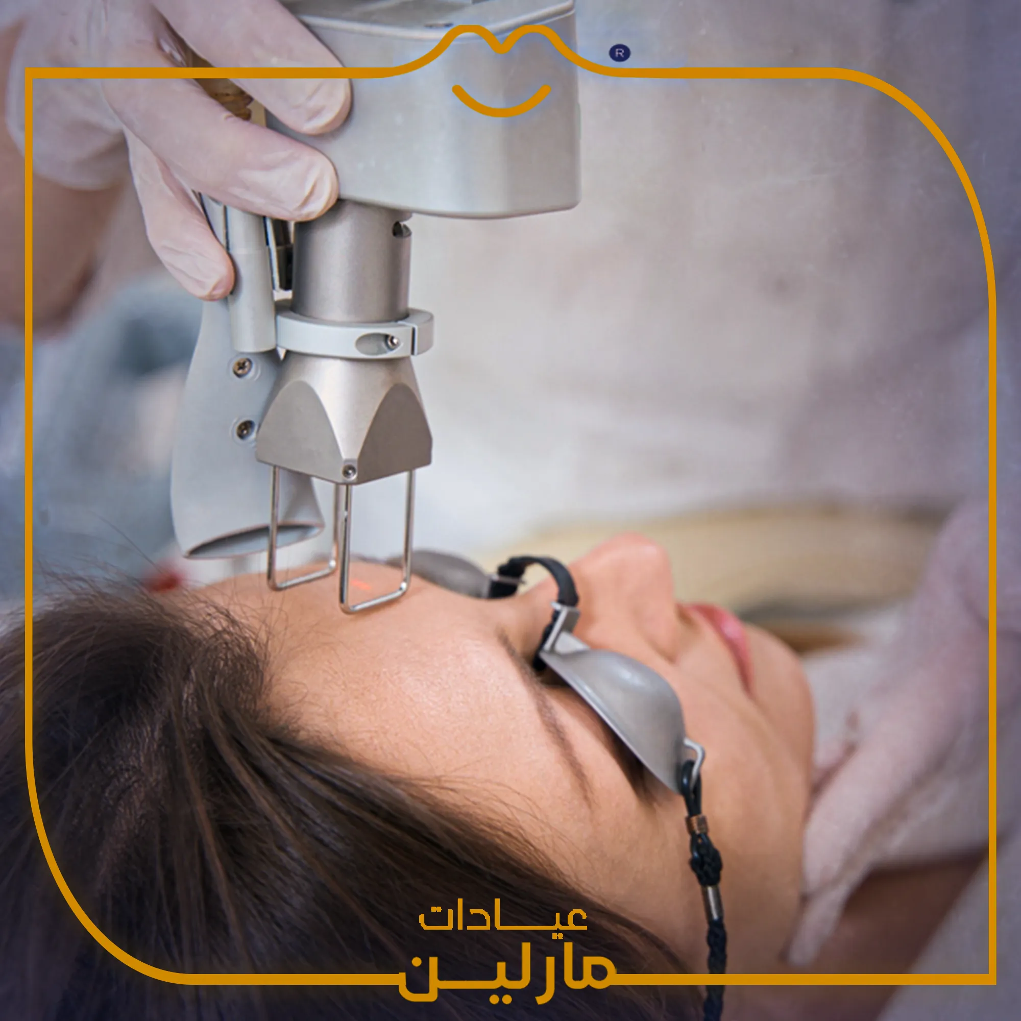 فراكشنال ليزر